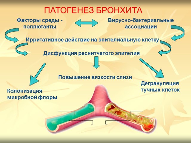 Бронхіт при вагітності - чим небезпечний, методи лікування