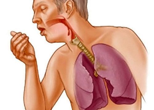 Глибокий кашель: причини, симптоми і лікування