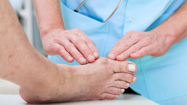 Артрит пальців ніг: симптоми і лікування, причини, ураження великого пальця