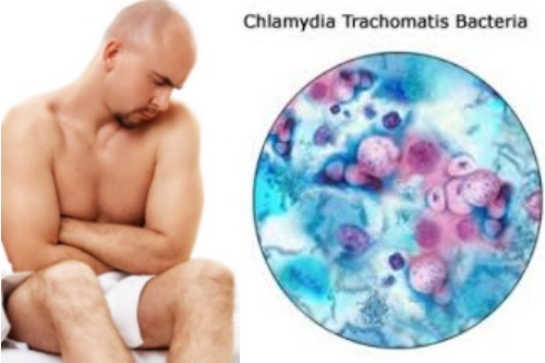 Chlamydia trachomatis ДНК: що це, симптоми і лікування хламідії у чоловіків