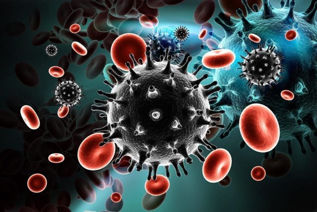 Пневмонія при ВІЛ: шляхи зараження, симптоми і лікування