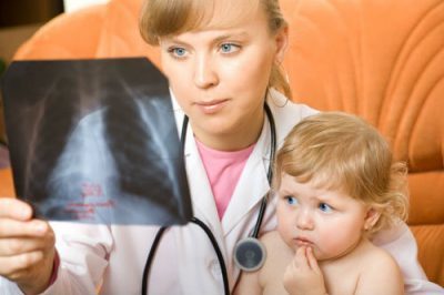 Кальцинати в легких у дорослих і дітей: симптоми і лікування