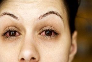 Очні краплі Натуральна сльоза: інструкція із застосування, відгуки про засіб для очей «Чиста сльоза»