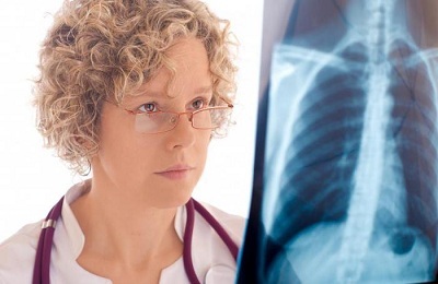 Затемнення в легенях на рентгені: про що свідетельмтсвуют зміни